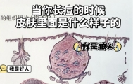 皮肤爆痘留印又留坑的真相